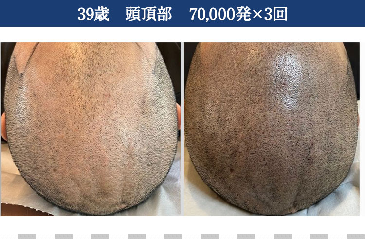 ｜スカルプインク沖縄