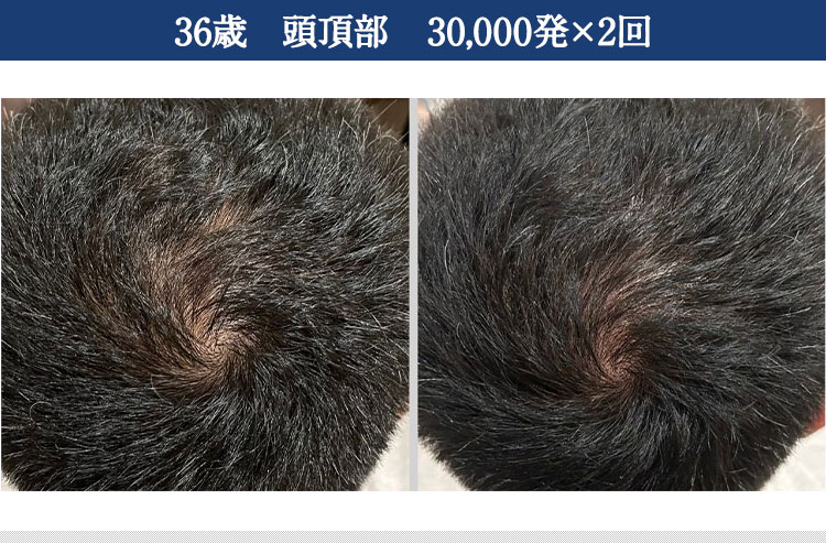 ｜スカルプインク沖縄