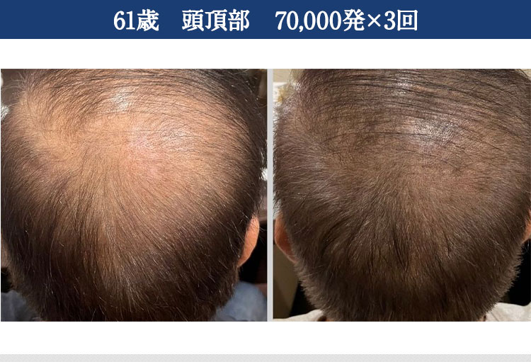 ｜スカルプインク沖縄