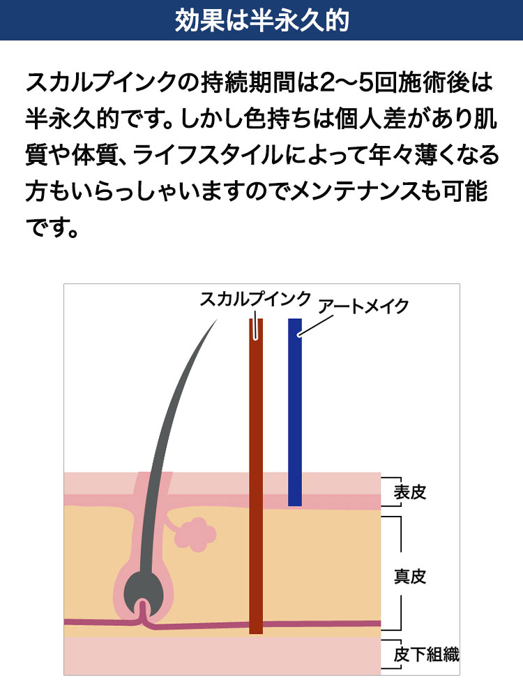 before after 効果は2〜3年持続｜スカルプインク沖縄