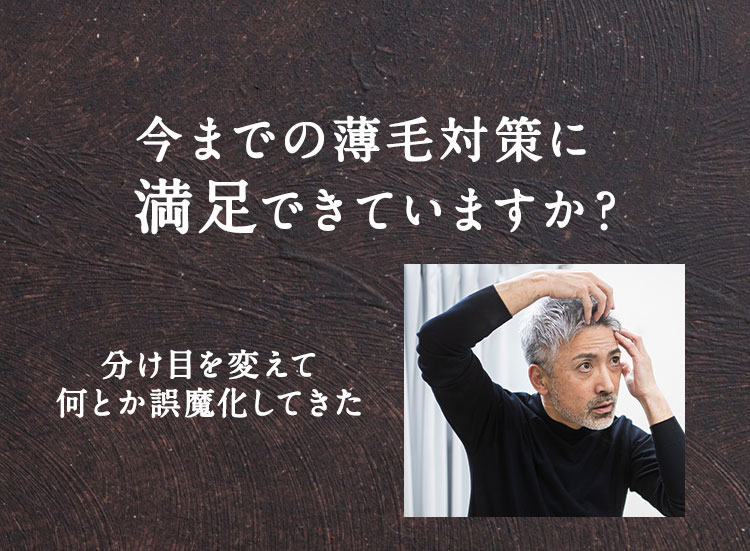 スカルプインクは従来のAGA治療とは異なり体毛が濃くなる等の副作用は一切なし！男性も安心して施術をお受けいただけます。｜スカルプインク沖縄