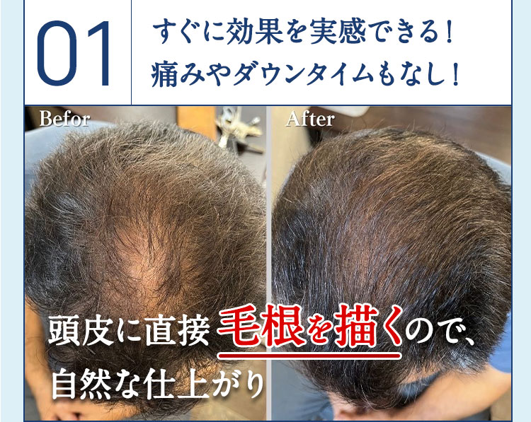 さらに｜スカルプインク沖縄