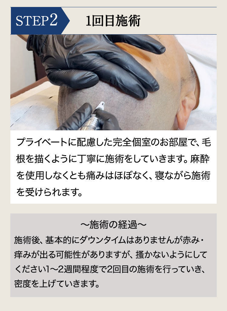 頭皮に直接毛を描くので、自然な仕上がり