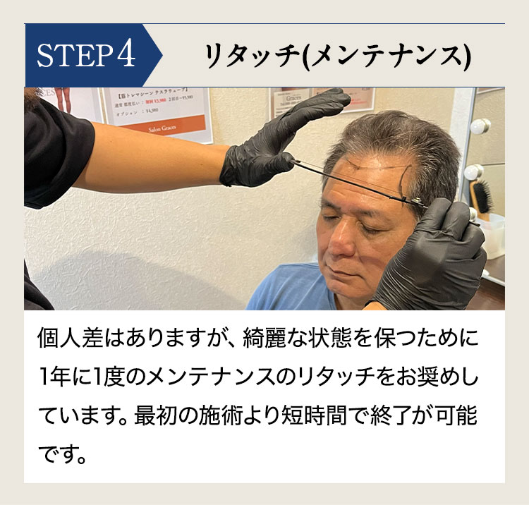 色素をドット状に入れていくことで、毛根の密度を高くし実際の毛根のような見栄えが表現できます。麻酔なしでも痛みを感じないのも特徴です。